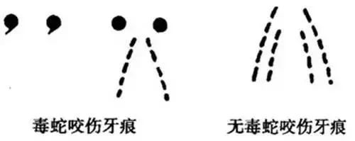被蛇咬傷怎么辦？ 福德醫(yī)院教你毒蛇咬傷急救指南